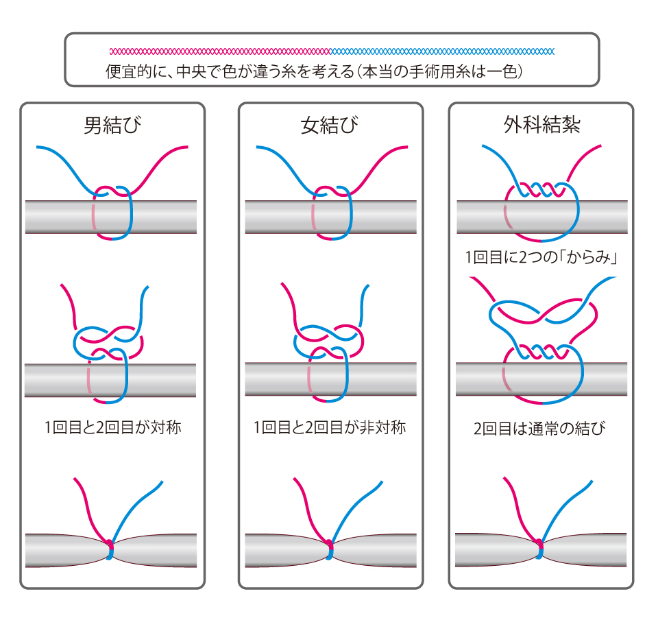 Mrnd Sohnd 結紮 | 口腔扁平上皮癌の治療法の選択基準に関する臨床的検討 – PMIOQD